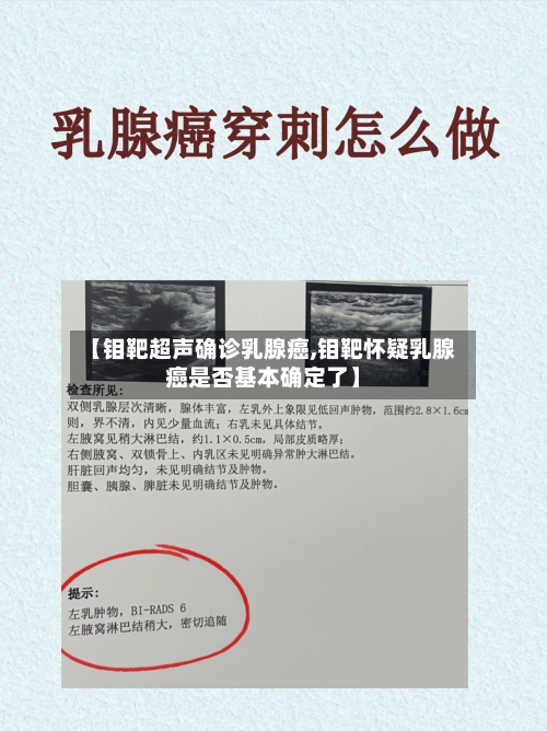 【钼靶超声确诊乳腺癌,钼靶怀疑乳腺癌是否基本确定了】