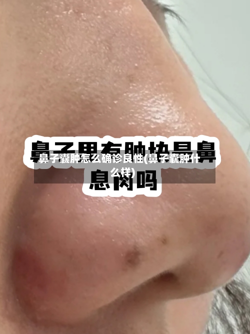 鼻子囊肿怎么确诊良性(鼻子囊肿什么样)