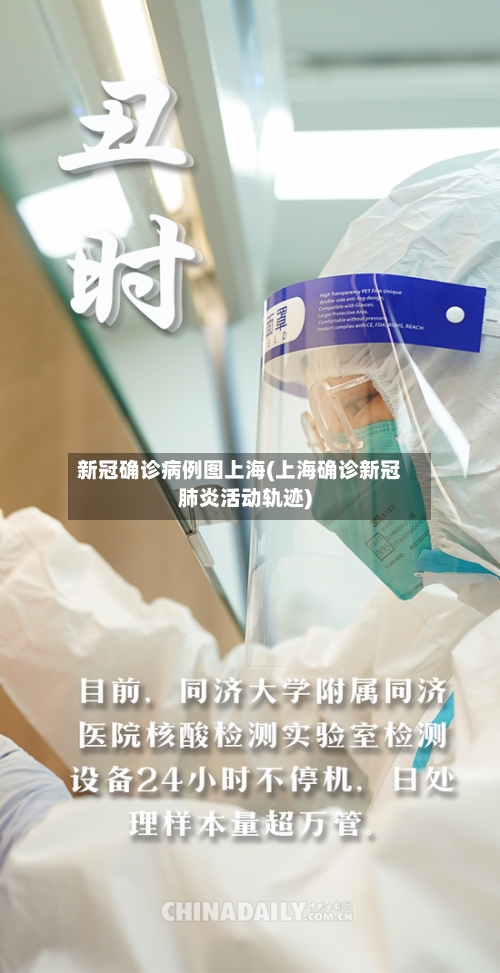 新冠确诊病例图上海(上海确诊新冠肺炎活动轨迹)