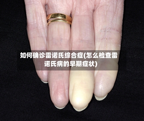 如何确诊雷诺氏综合症(怎么检查雷诺氏病的早期症状)-第3张图片