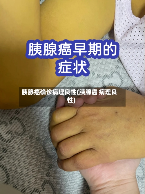 胰腺癌确诊病理良性(胰腺癌 病理良性)