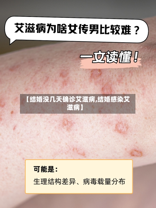 【结婚没几天确诊艾滋病,结婚感染艾滋病】