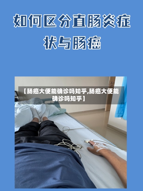 【肠癌大便能确诊吗知乎,肠癌大便能确诊吗知乎】