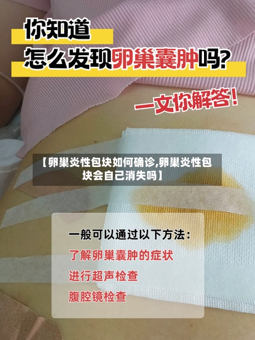 【卵巢炎性包块如何确诊,卵巢炎性包块会自己消失吗】-第2张图片