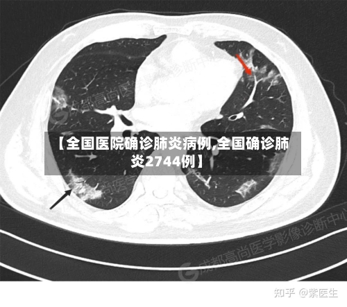 【全国医院确诊肺炎病例,全国确诊肺炎2744例】