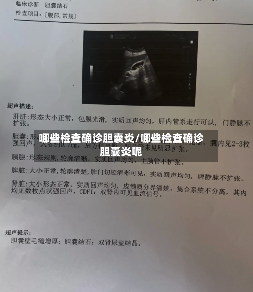 哪些检查确诊胆囊炎/哪些检查确诊胆囊炎呢