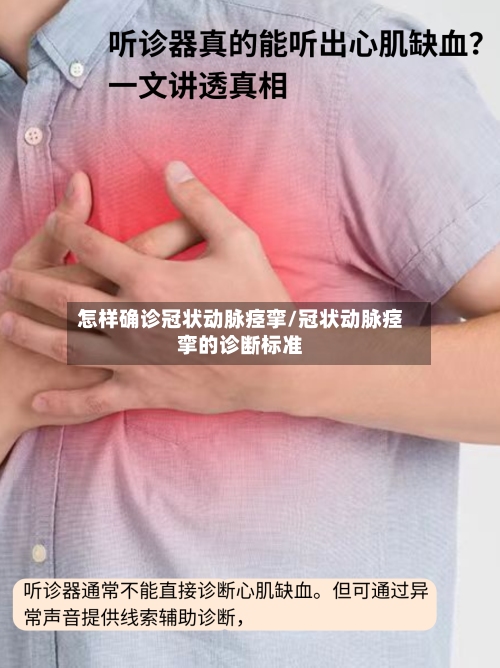 怎样确诊冠状动脉痉挛/冠状动脉痉挛的诊断标准-第2张图片