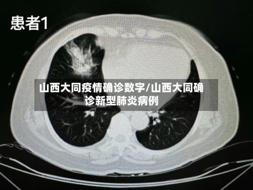 山西大同疫情确诊数字/山西大同确诊新型肺炎病例