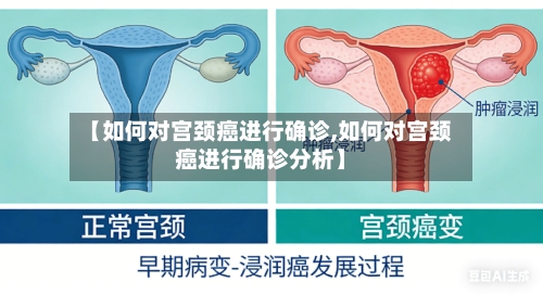 【如何对宫颈癌进行确诊,如何对宫颈癌进行确诊分析】