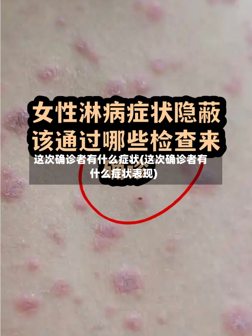 这次确诊者有什么症状(这次确诊者有什么症状表现)