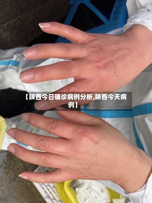 【陕西今日确诊病例分析,陕西今天病例】-第2张图片