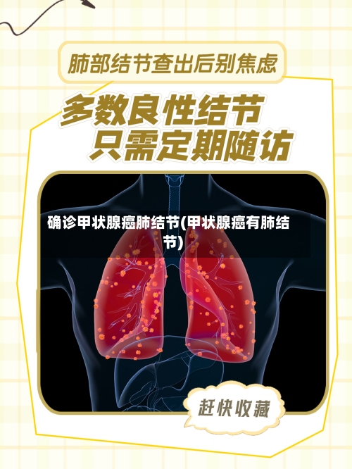 确诊甲状腺癌肺结节(甲状腺癌有肺结节)-第3张图片