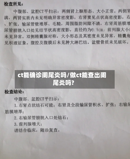 ct能确诊阑尾炎吗/做ct能查出阑尾炎吗?