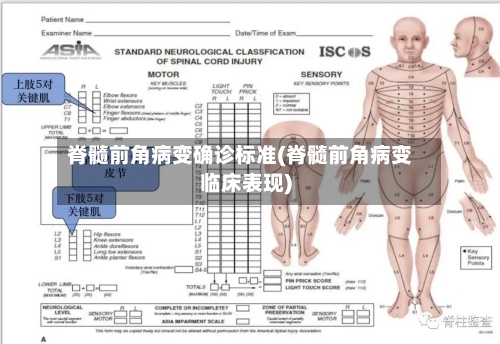 脊髓前角病变确诊标准(脊髓前角病变临床表现)-第2张图片