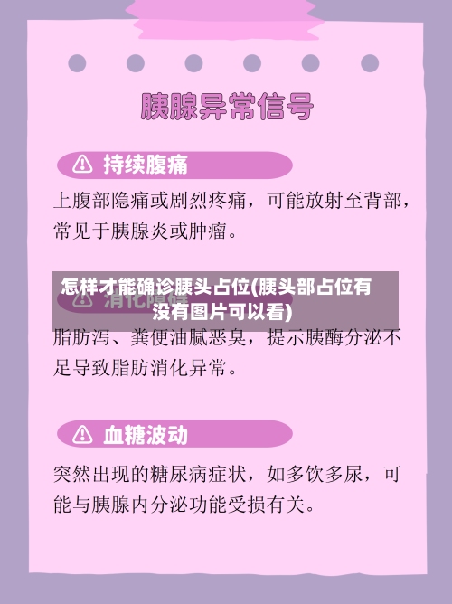 怎样才能确诊胰头占位(胰头部占位有没有图片可以看)