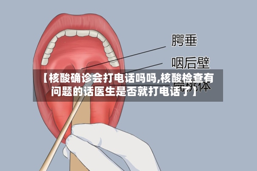 【核酸确诊会打电话吗吗,核酸检查有问题的话医生是否就打电话了】