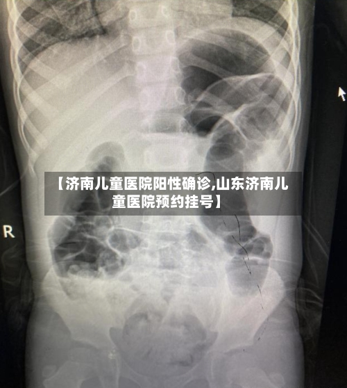 【济南儿童医院阳性确诊,山东济南儿童医院预约挂号】