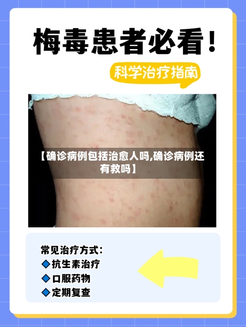 【确诊病例包括治愈人吗,确诊病例还有救吗】