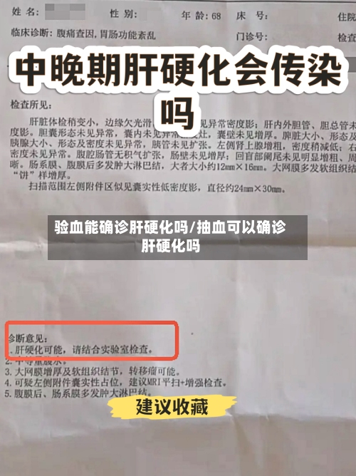 验血能确诊肝硬化吗/抽血可以确诊肝硬化吗
