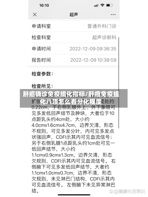肝癌确诊免疫组化指标/肝癌免疫组化八项怎么看分化程度
