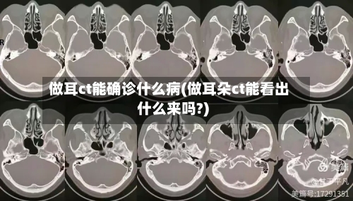 做耳ct能确诊什么病(做耳朵ct能看出什么来吗?)-第2张图片