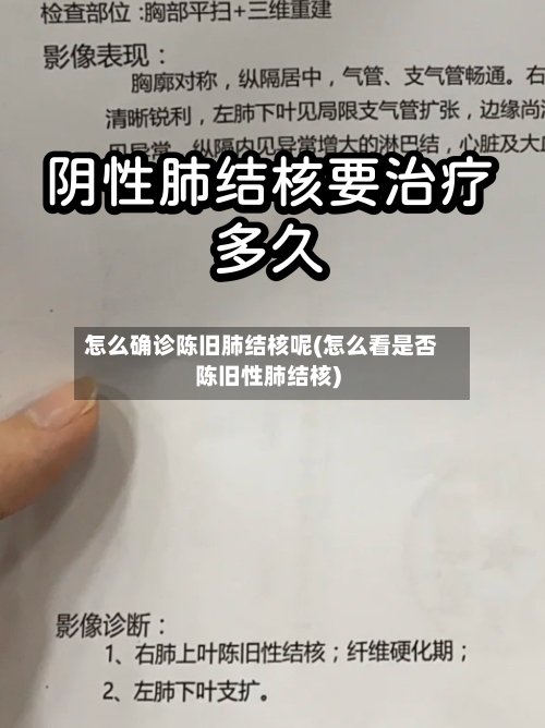 怎么确诊陈旧肺结核呢(怎么看是否陈旧性肺结核)-第2张图片