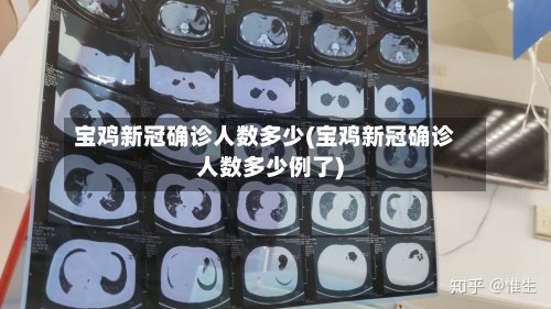 宝鸡新冠确诊人数多少(宝鸡新冠确诊人数多少例了)