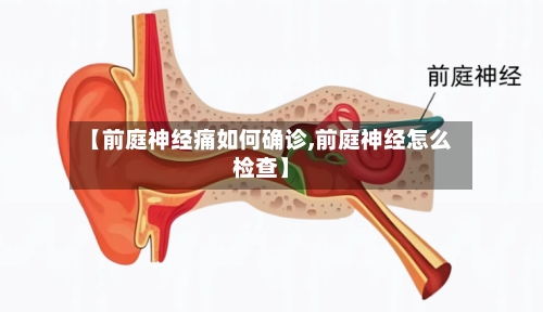 【前庭神经痛如何确诊,前庭神经怎么检查】-第3张图片