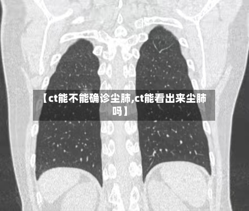 【ct能不能确诊尘肺,ct能看出来尘肺吗】-第2张图片