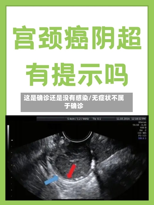 这是确诊还是没有感染/无症状不属于确诊-第2张图片