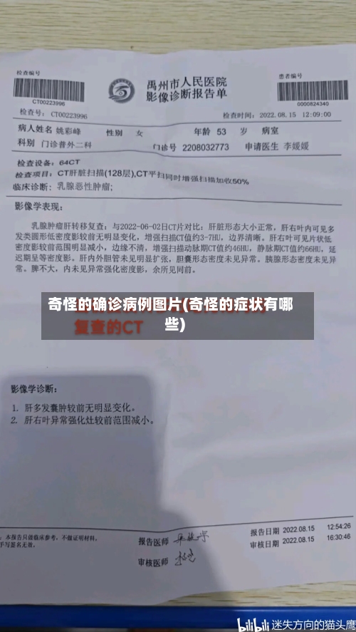 奇怪的确诊病例图片(奇怪的症状有哪些)