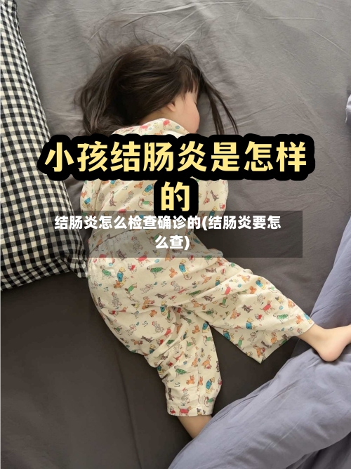 结肠炎怎么检查确诊的(结肠炎要怎么查)-第3张图片