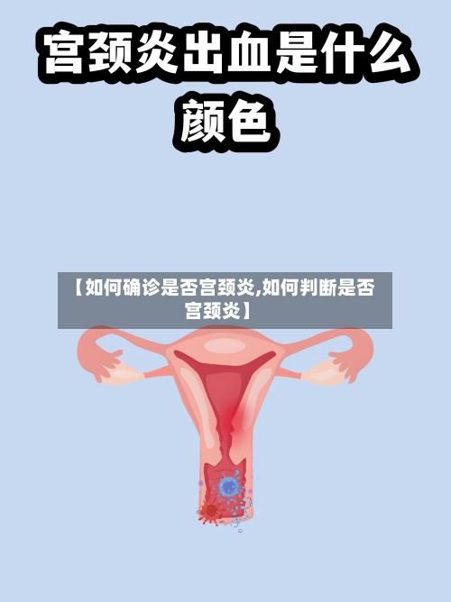 【如何确诊是否宫颈炎,如何判断是否宫颈炎】-第2张图片