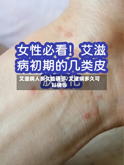 艾滋病人多久能确诊/艾滋病多久可以确诊