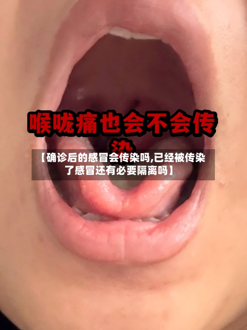 【确诊后的感冒会传染吗,已经被传染了感冒还有必要隔离吗】