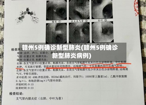 赣州5例确诊新型肺炎(赣州5例确诊新型肺炎病例)
